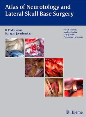 Imagem de Atlas of Neurotology and Lateral Skull Base Surgery