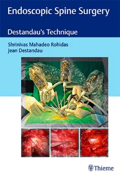 Imagem de Endoscopic Spine Surgery: Destandau's Technique