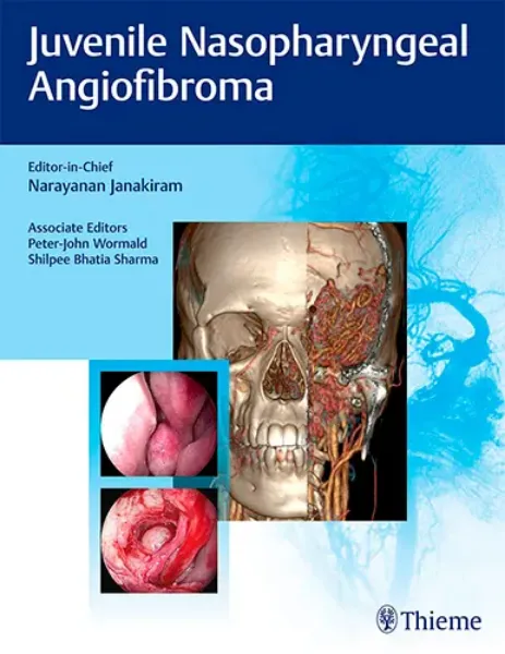 Picture of Book Juvenile Nasopharyngeal Angiofibroma