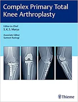 Imagem de Complex Primary Total Knee Arthroplasty