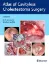 Picture of Book Atlas of Cavityless Cholesteatoma Surgery Vol. 1