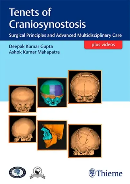 Imagem de Tenets of Craniosynostosis: Surgical Principles and Advanced Multidisciplinary Care