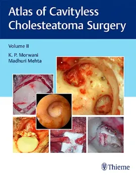 Picture of Book Atlas of Cavityless Cholesteatoma Surgery Vol. 2