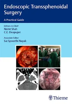 Imagem de Endoscopic Transsphenoidal Surgery: A Practical Guide
