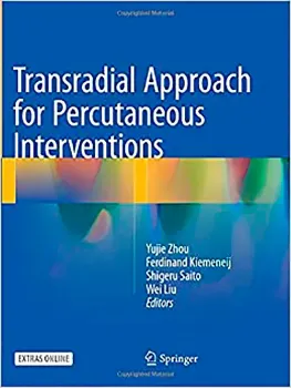 Imagem de Transradial Approach for Percutaneous Interventions