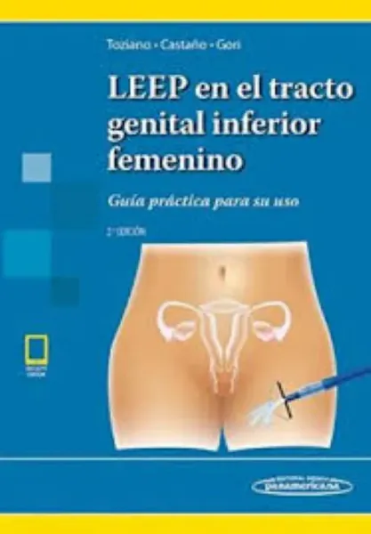 Imagem de LEEP en el Tracto Genital Inferior Femenino: Guía Práctica para su Uso