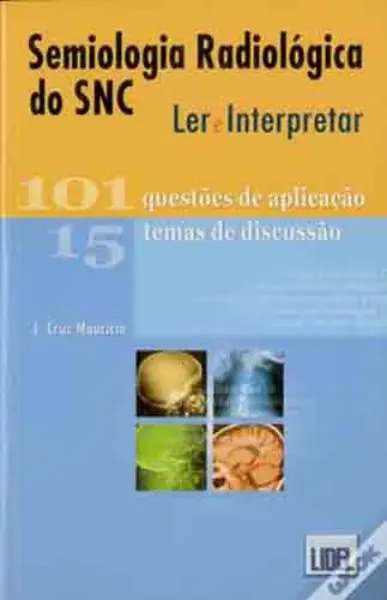 Imagem de Semiologia Radiológica do SNC - 101 Questões de Aplicação - 15 Temas de Discussão