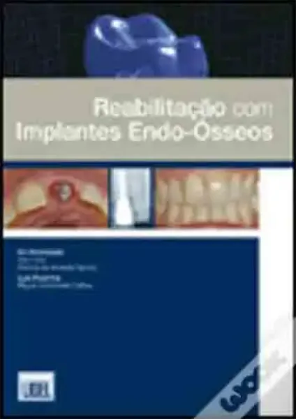 Imagem de Reabilitação com Implantes Endo-Ósseos