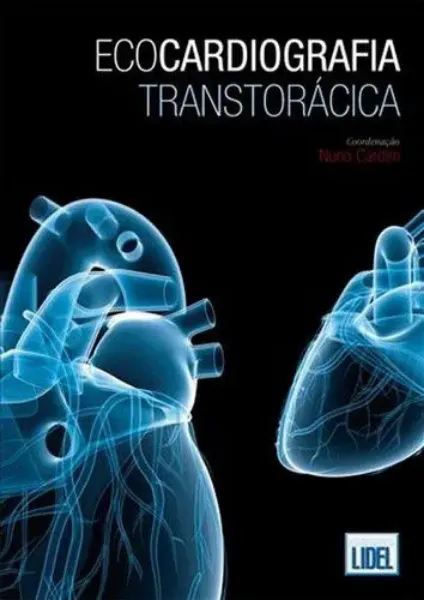 Imagem de Ecocardiografia Transtorácica