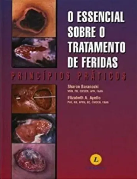 Imagem de O Essencial Sobre o Tratamento de Feridas