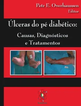 Picture of Book Úlceras do Pé Diabético: Causas, Diagnóstico e Tratamento