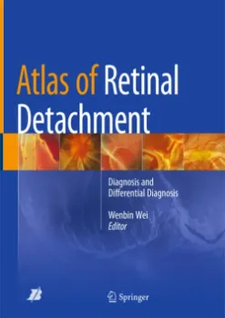 Imagem de Atlas of Retinal Detachment: Diagnosis and Differential Diagnosis