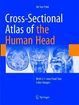Imagem de Cross-Sectional Atlas of the Human Head: With 0.1-mm Pixel Size Color Images