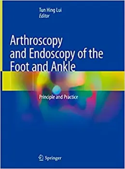 Imagem de Arthroscopy and Endoscopy of the Foot and Ankle: Principle and Practice