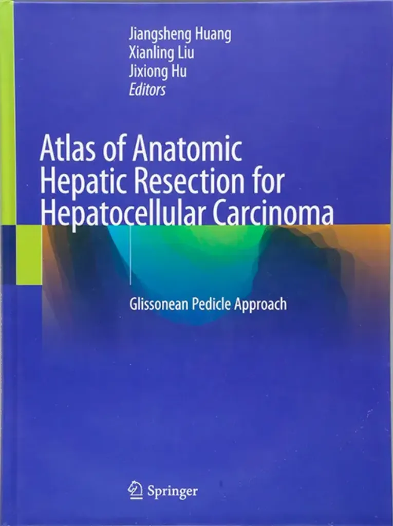 Imagem de Atlas of Anatomic Hepatic Resection for Hepatocellular Carcinoma: Glissonean Pedicle Approach