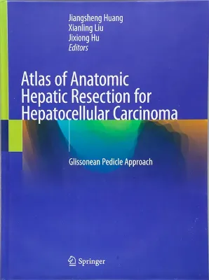 Imagem de Atlas of Anatomic Hepatic Resection for Hepatocellular Carcinoma: Glissonean Pedicle Approach