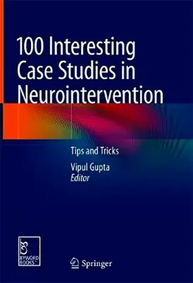 Imagem de 100 Interesting Case Studies in Neurointervention: Tips and Tricks