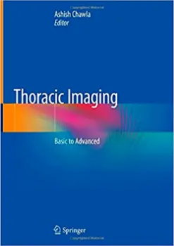 Picture of Book Thoracic Imaging: Basic to Advanced