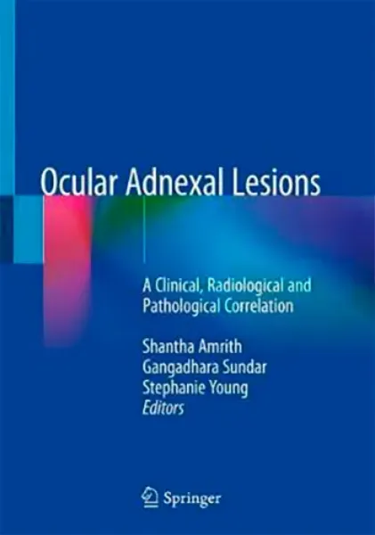 Imagem de Ocular Adnexal Lesions: A Clinical, Radiological and Pathological Correlation