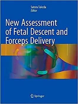 Imagem de New Assessment of Fetal Descent and Forceps Delivery