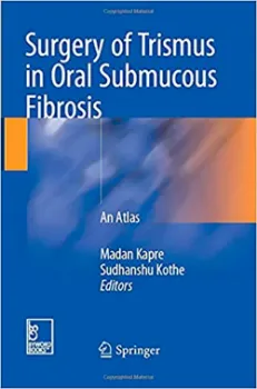 Imagem de Surgery of Trismus in Oral Submucous Fibrosis: An Atlas