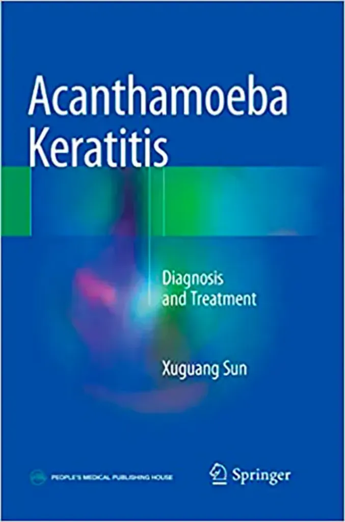 Imagem de Acanthamoeba Keratitis: Diagnosis and Treatment