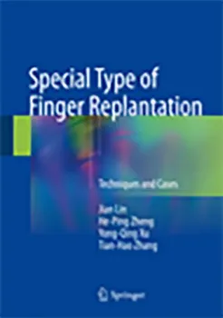 Picture of Book Special Type of Finger Replantation: Special Type of Finger Replantation Techniques and Cases
