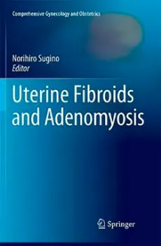 Picture of Book Uterine Fibroids and Adenomyosis