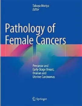 Imagem de Pathology of Female Cancers: Precursor and Early-Stage Breast, Ovarian and Uterine Carcinomas