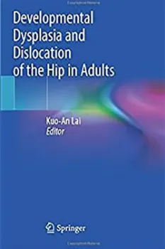 Picture of Book Developmental Dysplasia and Dislocation of the Hip in Adults
