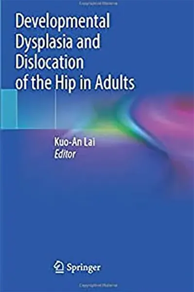 Imagem de Developmental Dysplasia and Dislocation of the Hip in Adults