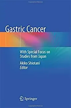 Imagem de Gastric Cancer: With Special Focus on Studies from Japan