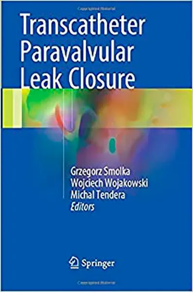 Imagem de Transcatheter Paravalvular Leak Closure