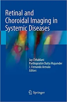 Imagem de Retinal and Choroidal Imaging in Systemic Diseases