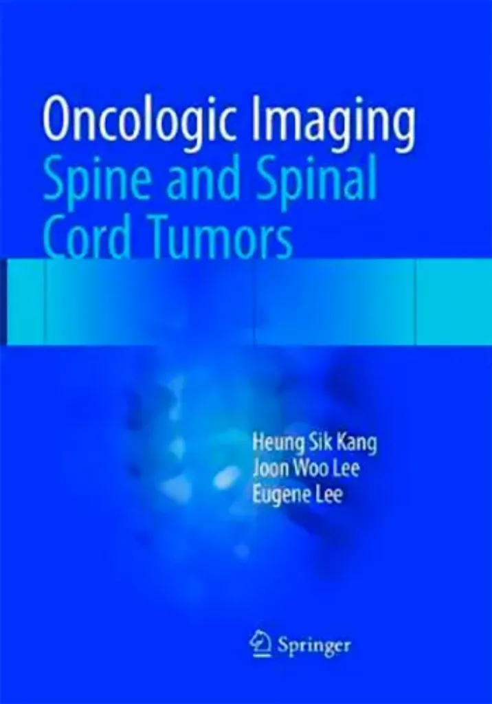 Imagem de Oncologic Imaging: Spine and Spinal Cord Tumors