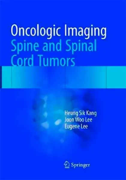 Imagem de Oncologic Imaging: Spine and Spinal Cord Tumors