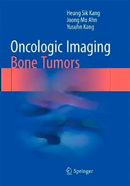 Imagem de Oncologic Imaging: Bone Tumors