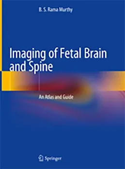 Picture of Book Imaging of Fetal Brain and Spine: An Atlas and Guide