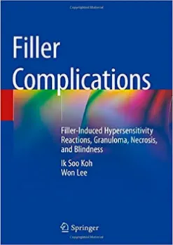 Imagem de Filler Complications: Filler-Induced Hypersensitivity Reactions, Granuloma, Necrosis, and Blindness