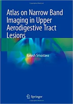 Imagem de Atlas on Narrow Band Imaging in Upper Aerodigestive Tract Lesions