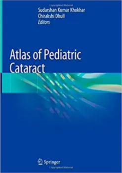 Imagem de Atlas of Pediatric Cataract