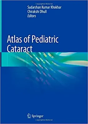 Imagem de Atlas of Pediatric Cataract