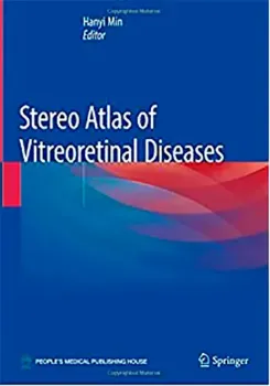 Picture of Book Stereo Atlas of Vitreoretinal Diseases