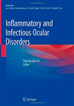 Picture of Book Inflammatory and Infectious Ocular Disorders