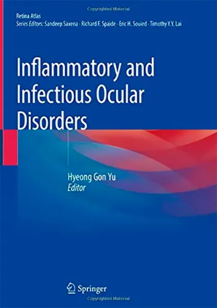 Imagem de Inflammatory and Infectious Ocular Disorders