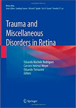 Imagem de Trauma and Miscellaneous Disorders in Retina