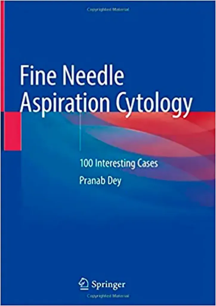 Imagem de Fine Needle Aspiration Cytology: 100 Interesting Cases