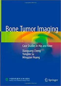 Picture of Book Bone Tumor Imaging: Case Studies in Hip and Knee