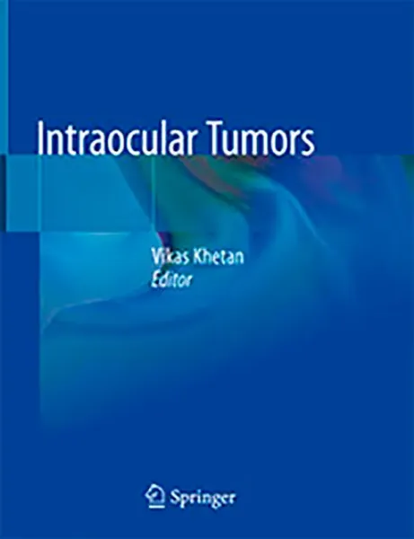 Imagem de Intraocular Tumors
