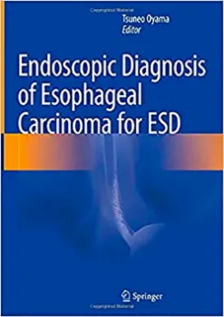 Picture of Book Endoscopic Diagnosis of Esophageal Carcinoma for ESD